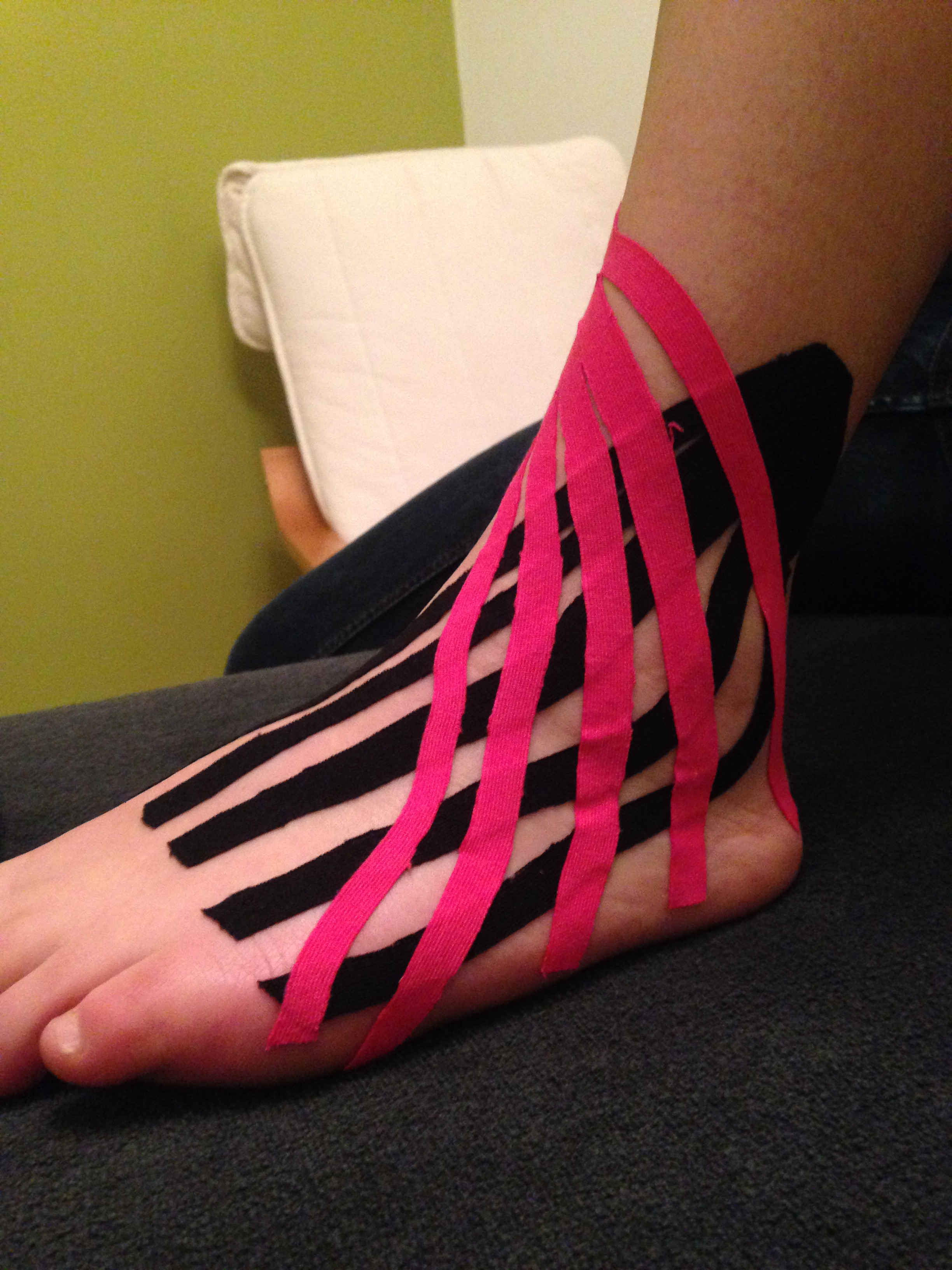 A fan of pink kinesio tape strips across the top of a foot and ankle, resting on a grey treatment couch