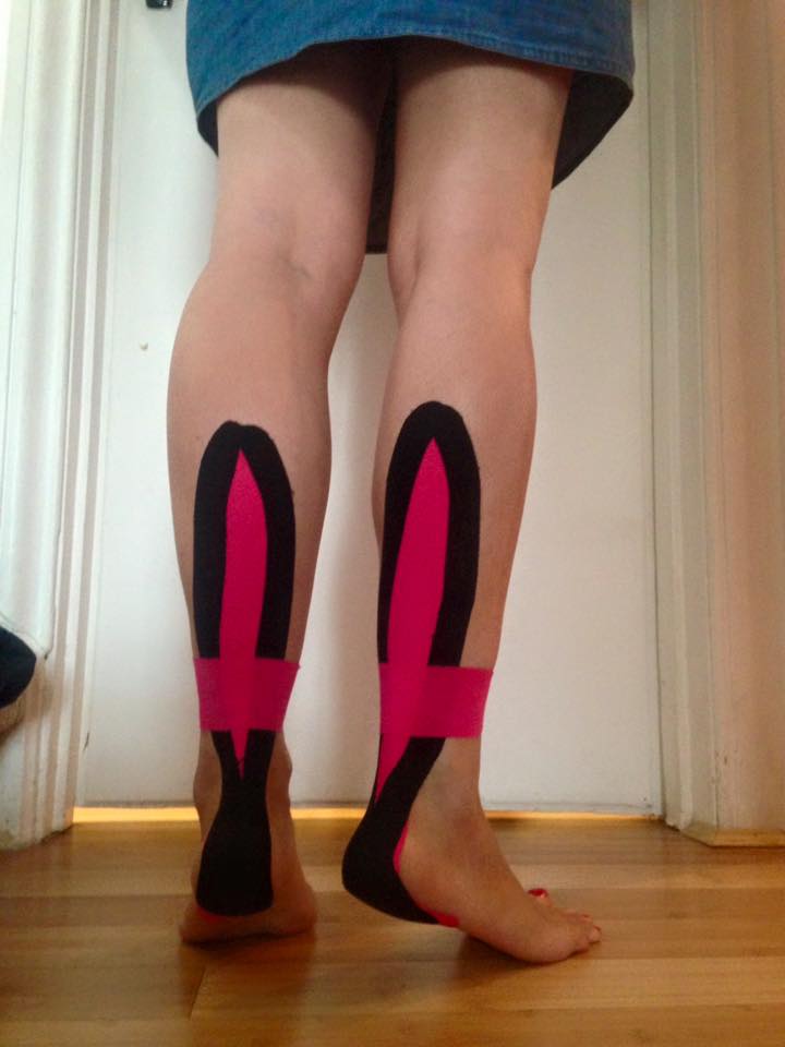 Both lower legs from behind with black and pink kinesio tape running up each calf