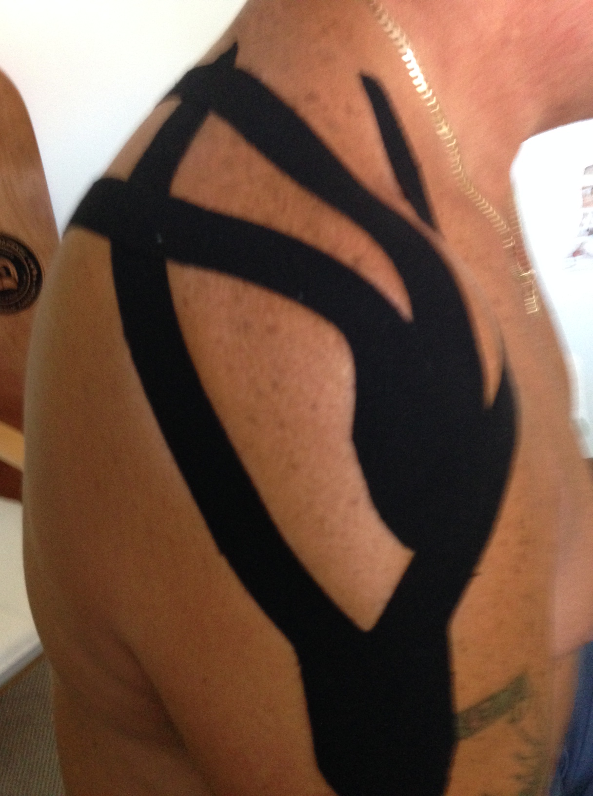Black kinesio tape in a wide V across a bare shoulder and deltoid